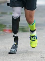 Dilakukan Fitting, 28 Difabel di Kalsel akan Dipasang Kaki dan Tangan Palsu