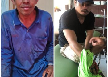 Dua Orang Berkelahi, Saling Lapor Polisi