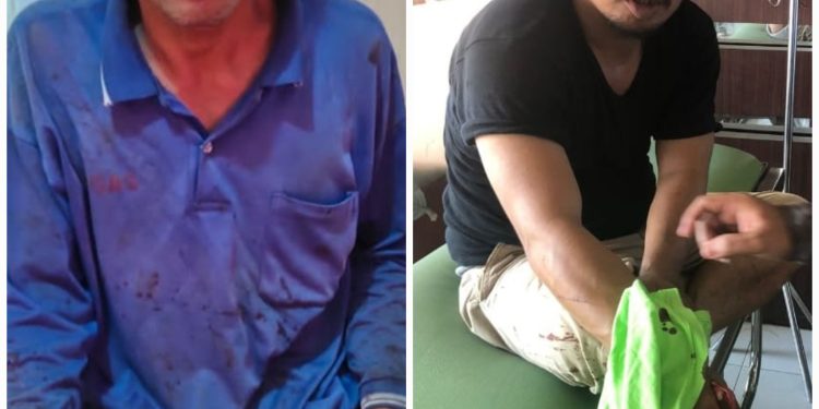 Dua Orang Berkelahi, Saling Lapor Polisi