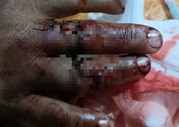 Pedagang Ikan di Sungai Danau Dibacok Dari Belakang