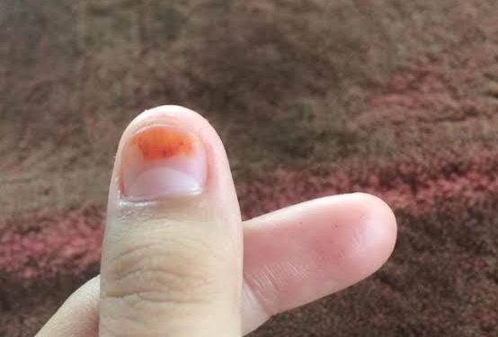 Kampanye Dimulai, ASN Dilarang Lakukan Gerakan 10 Pose Jari Ini, Termasuk Saranghaeyo