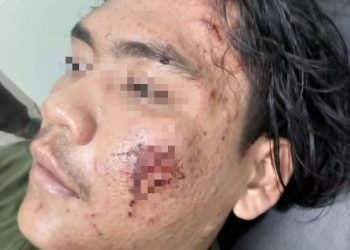 Zainudin dan Dedi Sufianda Jadi korban Pengeroyokan