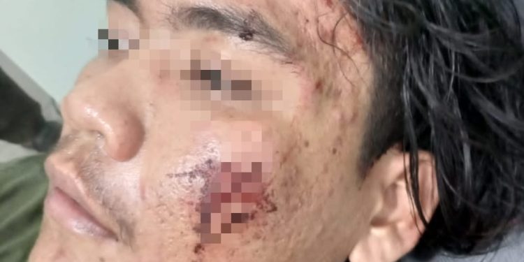 Zainudin dan Dedi Sufianda Jadi korban Pengeroyokan